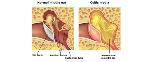 ear